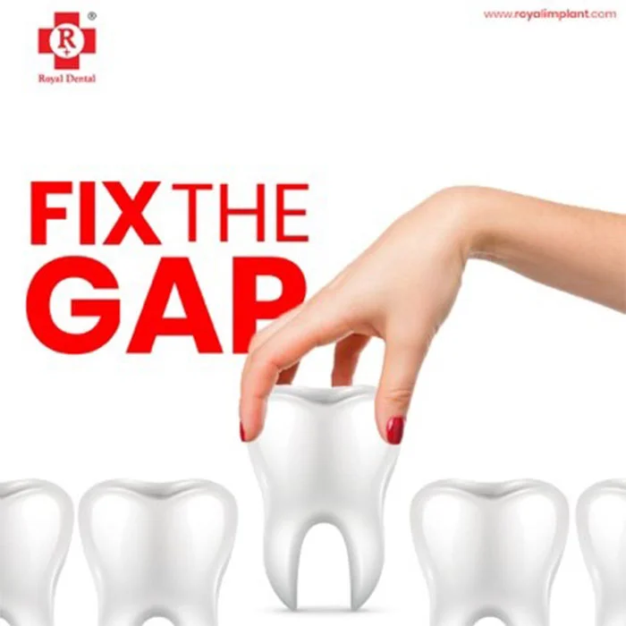 teeth-gap-treatment-kandivali